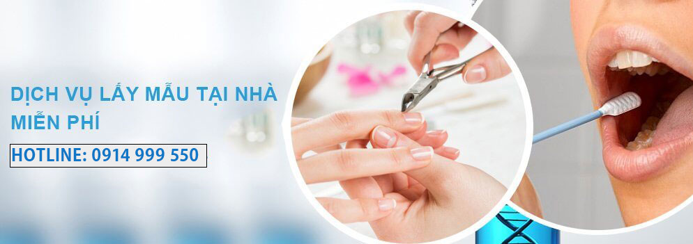 dich vu lay mau tai nha