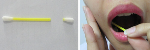 tu-thu-mau-niem-mac-miec-xet-nghiem-adn